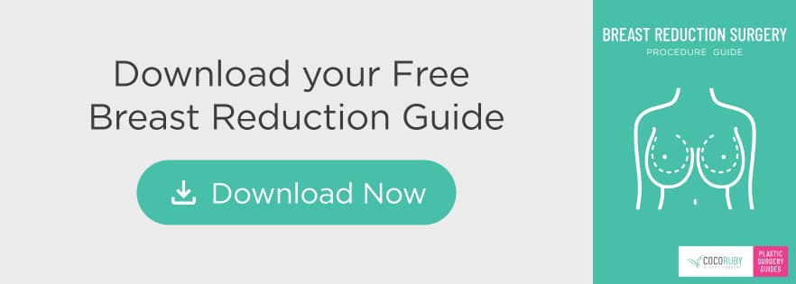 Breast Reduction Guide Download